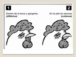 FORMA CUTÁNEA.  La forma cutánea se manifiesta por la presencia de nódulos localizados principalmente en las regiones sin plumas.