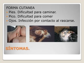 FORMA DIFTÉRICA.  La forma diftérica se caracteriza por la formación de pequeñas pseudo membranas localizadas en la cavidad bucal, faringe y laringe.