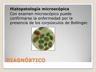 SÍNTOMAS.FORMA DIFTERICAUno de los primeros problemas que el ave afectada por la forma diftérica presenta es la dificultad para ingerir alimentos.