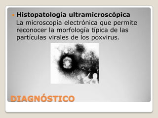 LESIONES QUE EL POXVIRUS CAUSA.Las células epiteliales sufren un proceso de tumefacción y presentación citoplasmáticas llamadas inclusiones de Bollinger, en el interior de las cuales encontramos los corpúsculos de Borrel, que son considerados como corpúsculos elementales del virus.En la forma diftérica, las lesiones de la mucosa del tracto digestivo se caracterizan por la formación de las pseudo membranas de coloración blanquecinas.