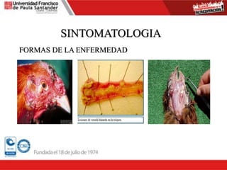 SINTOMATOLOGIA
FORMAS DE LA ENFERMEDAD
 