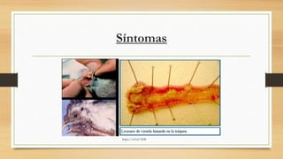 Síntomas
https://n9.cl/1838
 