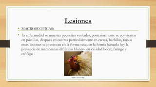 Lesiones
• MACROSCOPICAS:
• la enfermedad se muestra pequeñas vesículas, posteriormente se convierten
en pústulas, después en costras particularmente en cresta, barbillas, tarsos
estas lesiones se presentan en la forma seca; en la forma húmeda hay la
presencia de membranas diftéricas blanco- en cavidad bocal, faringe y
esófago
https://n9.cl/j0gf
 