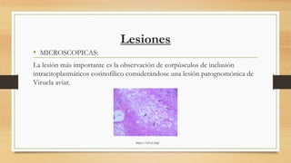Lesiones
• MICROSCOPICAS:
La lesión más importante es la observación de corpúsculos de inclusión
intracitoplasmáticos eosinofilico considerándose una lesión patognomónica de
Viruela aviar.
https://n9.cl/j0gf
 