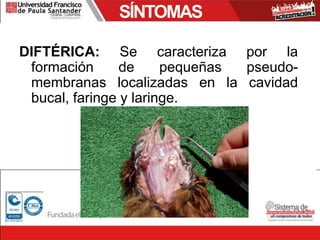 SÍNTOMAS
DIFTÉRICA: Se caracteriza por la
formación de pequeñas pseudo-
membranas localizadas en la cavidad
bucal, faringe y laringe.
 