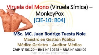 Viruela del Mono (Viruela Símica) –
MonkeyPox
[CIE-10: B04]
MSc. MC. Juan Rodrigo Tuesta Nole
Maestro en Gestión Pública
Médico Geriatra – Auditor Médico
CMP N° 56120 – RNE N° 30248 – RNA N° A06409
 