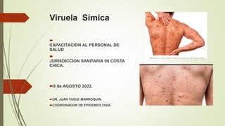 Viruela Símica

CAPACITACION AL PERSONAL DE
SALUD

JURISDICCION SANITARIA 06 COSTA
CHICA.
8 de AGOSTO 2022.
DR. JUAN TAGLE MARROQUIN.
COORDINADOR DE EPIDEMIOLOGIA.
 