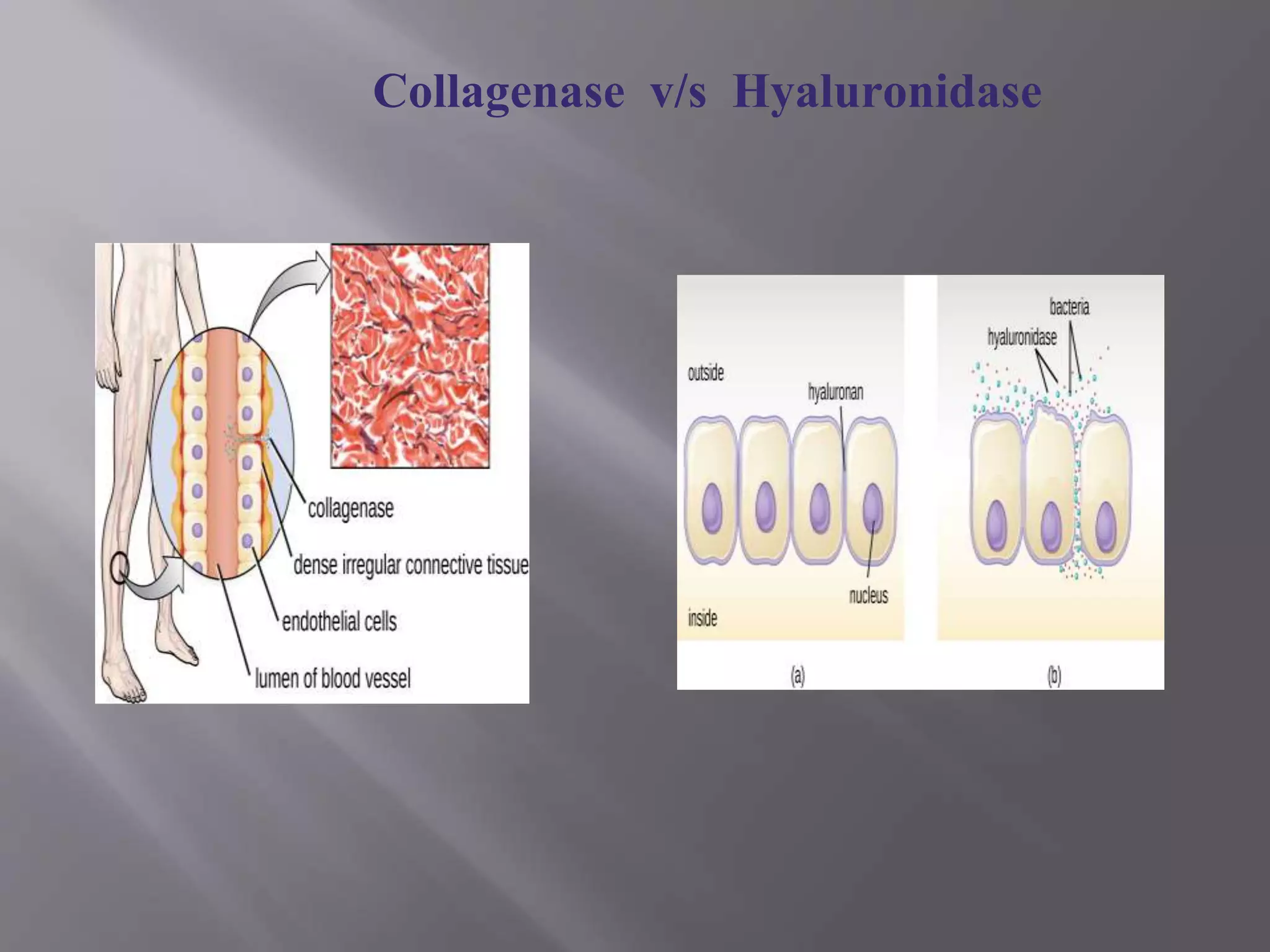 Collagenase v/s Hyaluronidase
 