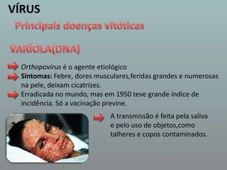 VÍRUSPrincipais doenças vitóticasVARÍOLA(DNA)Orthopovirusé o agente etiológicoSintomas: Febre, dores musculares,feridas grandes e numerosas na pele, deixam cicatrizes. Erradicada no mundo, mas em 1950 teve grande índice de incidência. Só a vacinação previne.A transmissão é feita pela saliva e pelo uso de objetos,como talheres e copos contaminados.