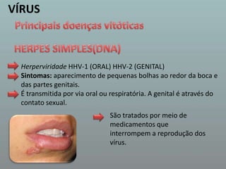 VÍRUSPrincipais doenças vitóticasHERPES SIMPLES(DNA)HerperviridadeHHV-1 (ORAL) HHV-2 (GENITAL)Sintomas: aparecimento de pequenas bolhas ao redor da boca e das partes genitais. É transmitida por via oral ou respiratória. A genital é através do contato sexual. São tratados por meio de medicamentos que interrompem a reprodução dos vírus. 