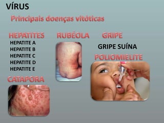 VÍRUSPrincipais doenças vitóticasHEPATITES RUBÉOLA GRIPE HEPATITE AHEPATITE BHEPATITE CHEPATITE DHEPATITE EGRIPE SUÍNAPOLIOMIELITE CATAPORA 