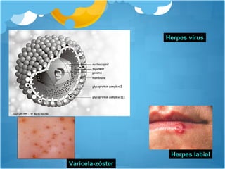 Herpes virus
Varicela-zóster
Herpes labial
 