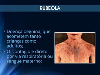 RUBEÓLA

•

•

Doença begnina, que
acometem tanto
crianças como
adultos;
O contágio é direto
por via respiratória ou
sangue materno;

 