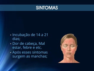 SINTOMAS

Incubação de 14 a 21
dias;
• Dor de cabeça, Mal
estar, febre e etc.
• Após esses sintomas
surgem as manchas;
•

 