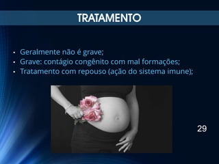 TRATAMENTO
•
•
•

Geralmente não é grave;
Grave: contágio congênito com mal formações;
Tratamento com repouso (ação do sistema imune);

29

 
