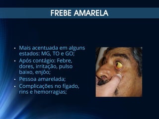 FREBE AMARELA

Mais acentuada em alguns
estados: MG, TO e GO;
• Após contágio: Febre,
dores, irritação, pulso
baixo, enjôo;
• Pessoa amarelada;
• Complicações no fígado,
rins e hemorragias;
•

 