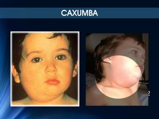 CAXUMBA

42

 