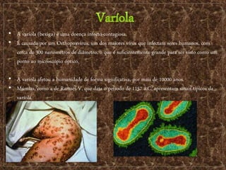 • A varíola (bexiga) é uma doença infecto-contagiosa.
• É causada por um Orthopoxvirus, um dos maiores vírus que infectam seres humanos, com
cerca de 300 nanometros de diâmetro, o que é suficientemente grande para ser visto como um
ponto ao microscópio óptico.
• A varíola afetou a humanidade de forma significativa, por mais de 10000 anos.
• Múmias, como a de Ramsés V, que data o período de 1157 a.C, apresentam sinais típicos da
varíola.
 