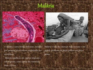 A malária é uma doença infeciosa, causada
por parasitas protozoários, transmitida por
mosquitos.
Malária espalha-se em regiões tropicais e
sub-tropicais, como partes das Américas,
Ásia e África.
Malária é uma das doenças mais comuns e um
grande problema de saúde pública em vários
países.
 