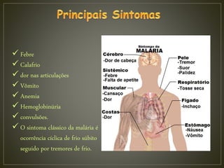  Febre
 Calafrio
 dor nas articulações
 Vômito
 Anemia
 Hemoglobinúria
 convulsões.
 O sintoma clássico da malária é
ocorrência cíclica de frio súbito
seguido por tremores de frio.
 