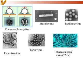 Contrastação negativa 
Baculovírus Papilomavírus 
Paramixovírus 
Parvovírus 
Tobacco mosaic 
virus (TMV) 
 