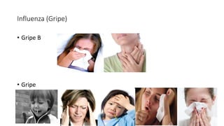 Influenza (Gripe)
• Gripe B
• Gripe
 