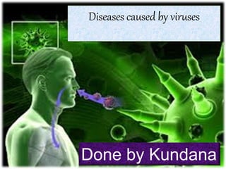 Diseases caused by viruses
Done by Kundana
 