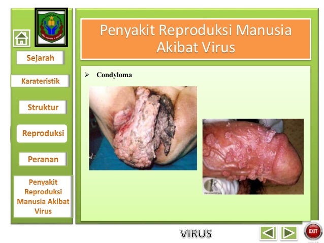 Virus