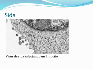 Sida
Virus de sida infectando un linfocito
 