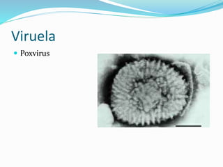 Viruela
 Poxvirus
 
