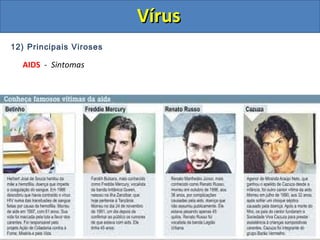 12) Principais Viroses
AIDS - Sintomas
VírusVírus
 