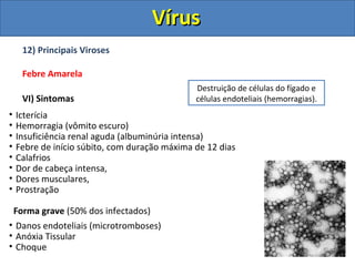12) Principais Viroses
Febre Amarela
VI) Sintomas
• Icterícia
• Hemorragia (vômito escuro)
• Insuficiência renal aguda (albuminúria intensa)
• Febre de início súbito, com duração máxima de 12 dias
• Calafrios
• Dor de cabeça intensa,
• Dores musculares,
• Prostração
Forma grave (50% dos infectados)
• Danos endoteliais (microtromboses)
• Anóxia Tissular
• Choque
Destruição de células do fígado e
células endoteliais (hemorragias).
VírusVírus
 