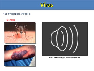 12) Principais Viroses
Dengue
Placa de sinalização: criadouro de larvas.
VírusVírus
 
