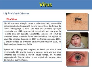 12) Principais Viroses
Zika Vírus
Zika Vírus é uma infecção causada pelo vírus ZIKV, transmitida
pelo mosquito Aedes aegypti, mesmo transmissor da dengue da
febre chikungunya. O vírus Zika teve sua primeira aparição
registrada em 1947, quando foi encontrado em macacos da
Floresta Zika, em Uganda. Entretanto, somente em 1954 os
primeiros seres humanos foram contaminados, na Nigéria. O
vírus Zika atingiu a Oceania em 2007 e a França no ano de 2013.
O Brasil notificou os primeiros casos de Zika vírus em 2015, no
Rio Grande do Norte e na Bahia.
Apesar de a doença ter chegado ao Brasil, ela não é uma
preocupação tão grande quanto a dengue, uma vez que seus
sintomas são brandos e duram pouco tempo. Os maiores
incômodos são febre é baixa, coceira e comichão na pele, além
de manchas avermelhadas.
VírusVírus
 