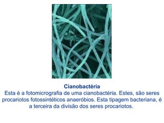 Cianobactéria
Esta é a fotomicrografia de uma cianobactéria. Estes, são seres
procariotos fotossintéticos anaeróbios. Esta tipagem bacteriana, é
a terceira da divisão dos seres procariotos.
 
