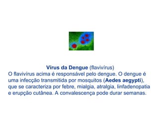 Vírus da Dengue (flavivírus)
O flavivírus acima é responsável pelo dengue. O dengue é
uma infecção transmitida por mosquitos (Aedes aegypti),
que se caracteriza por febre, mialgia, atralgia, linfadenopatia
e erupção cutânea. A convalescença pode durar semanas.
 