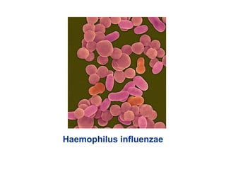 Haemophilus influenzae
 