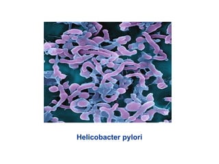 Helicobacter pylori
 