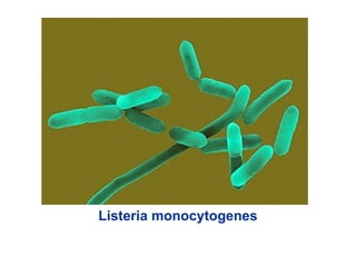 Listeria monocytogenes
 