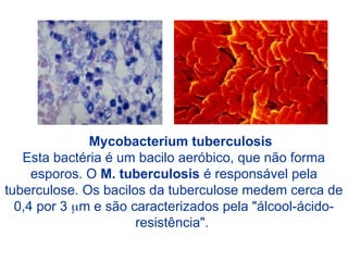 Mycobacterium tuberculosis
Esta bactéria é um bacilo aeróbico, que não forma
esporos. O M. tuberculosis é responsável pela
tuberculose. Os bacilos da tuberculose medem cerca de
0,4 por 3 m e são caracterizados pela "álcool-ácido-
resistência".
 