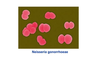 Neisseria gonorrhoeae
 