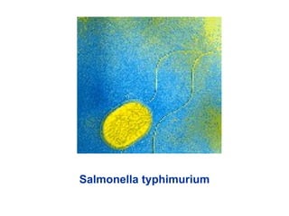 Salmonella typhimurium
 