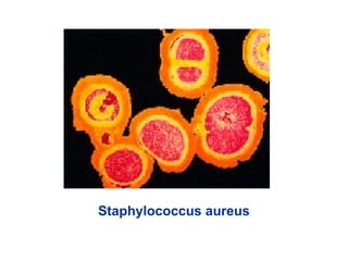 Staphylococcus aureus
 