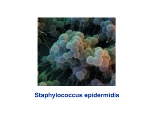Staphylococcus epidermidis
 