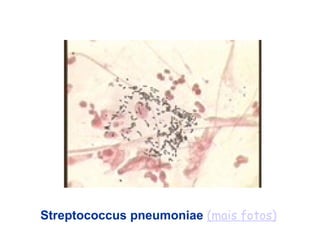 Streptococcus pneumoniae (mais fotos)
 