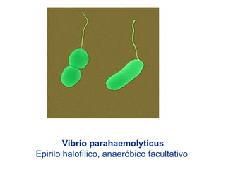 Vibrio parahaemolyticus
Epirilo halofílico, anaeróbico facultativo
 