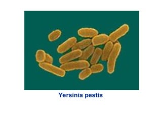 Yersinia pestis
 