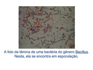 A foto da lâmina de uma bactéria do gênero Bacillus.
Nesta, ela se encontra em esporulação.
 