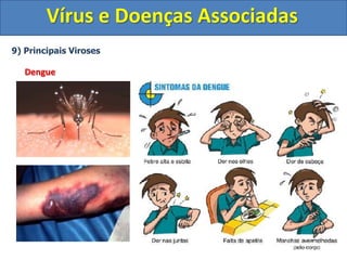 Vírus e Doenças Associadas
9) Principais Viroses
Dengue
 