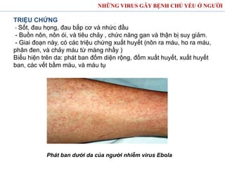 TRIỆU CHỨNG
- Sốt, đau họng, đau bắp cơ và nhức đầu
- Buồn nôn, nôn ói, và tiêu chảy , chức năng gan và thận bị suy giảm.
- Giai đoạn này, có các triệu chứng xuất huyết (nôn ra máu, ho ra máu,
phân đen, và chảy máu từ màng nhầy )
Biểu hiện trên da: phát ban đốm diện rộng, đốm xuất huyết, xuất huyết
ban, các vết bầm máu, và máu tụ
NHỮNG VIRUS GÂY BỆNH CHỦ YẾU Ở NGƯỜI
Phát ban dưới da của người nhiễm virus Ebola
 